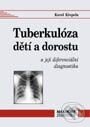 Kniha: Tuberkulóza dětí a dorostu (Karel Křepela). Maxdorf, 2001 Kniha: Tuberkulóza dětí a dorostu (Karel Křepela). Maxdorf, 2001
