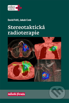 Kniha: Stereotaktická radioterapie (David Feltl a Jakub Cvek). Mladá fronta, 2019 Kniha: Stereotaktická radioterapie (David Feltl a Jakub Cvek). Mladá fronta, 2019