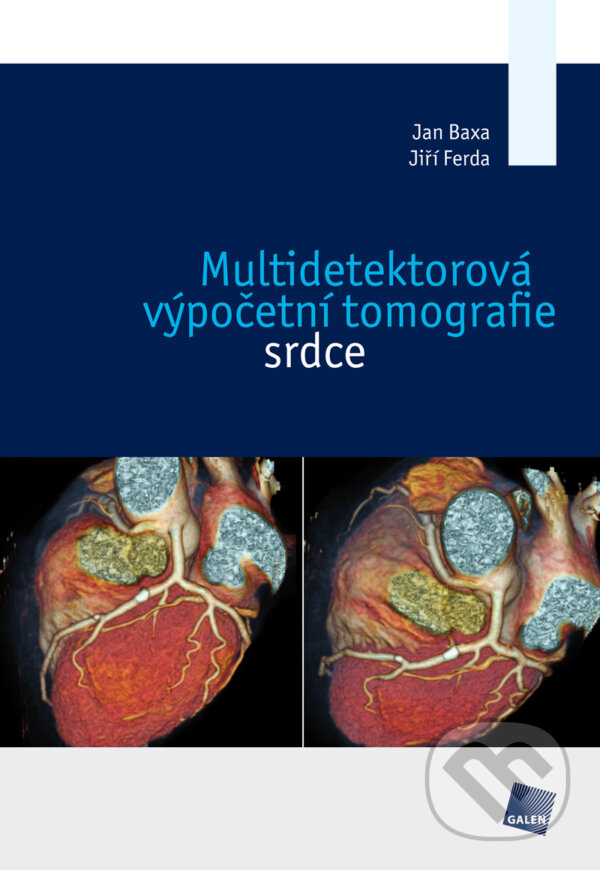 E-kniha: Multidetektorová výpočetní tomografie srdce (Jan Baxa a Jiří Ferda). Galén, 2012 E-kniha: Multidetektorová výpočetní tomografie srdce (Jan Baxa a Jiří Ferda). Galén, 2012