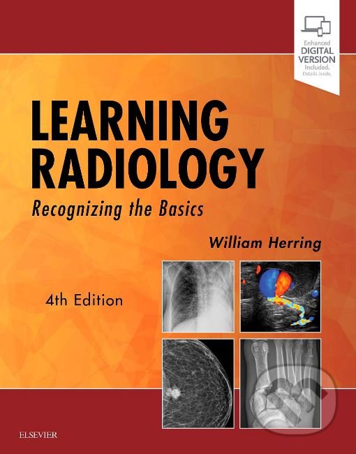 Kniha: Learning Radiology (William Herring). Elsevier Science, 2019 Kniha: Learning Radiology (William Herring). Elsevier Science, 2019