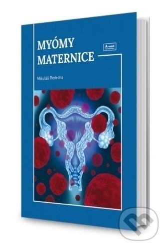 Kniha: Myómy maternice (Mikuláš Redecha). A-medi management, 2019 Kniha: Myómy maternice (Mikuláš Redecha). A-medi management, 2019