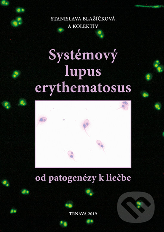 Kniha: Systémový lupus erythematosus (Autorský kolektiv). Magnet Press, 2019 Kniha: Systémový lupus erythematosus (Autorský kolektiv). Magnet Press, 2019