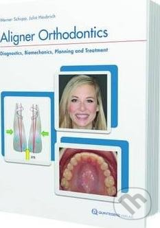 Kniha: Aligner Orthodontics (Julia Haubrich a Werner Schup). Quintessenz Verlags, 2017 Kniha: Aligner Orthodontics (Julia Haubrich a Werner Schup). Quintessenz Verlags, 2017