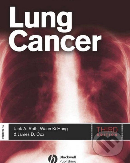 Lung Cancer - Jack A. Roth, James D. Cox, Waun Ki Hong, Wiley-Blackwell, 2008