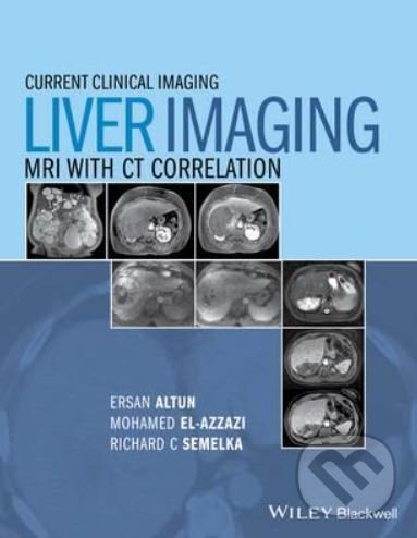 Kniha: Liver Imaging (Ersan Altun, Larissa Braga, Mohamed Elazzazi a Richard C. Semelka). John Wiley & Sons, 2015 Kniha: Liver Imaging (Ersan Altun, Larissa Braga, Mohamed Elazzazi a Richard C. Semelka). John Wiley & Sons, 2015