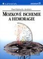 Mozkové ischemie a hemoragie