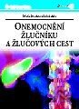 Onemocnění žlučníku a žlučových cest