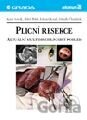 Plicní resekce - aktuální multidisciplinární pohled