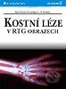 Kostní léze v rentgenovém obraze