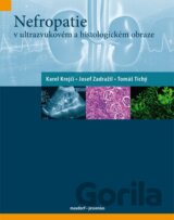 Nefropatie v ultrazvukovém a histologickém obraze