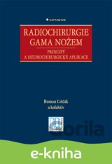 Radiochirurgie gama nožem