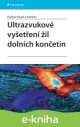 Ultrazvukové vyšetření žil dolních končetin