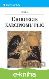 Chirurgie karcinomu plic