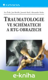 Traumatologie ve schématech a RTG obrazech