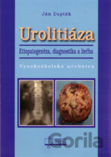 Urolitiáza