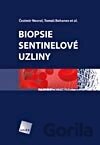 Biopsie sentinelové uzliny
