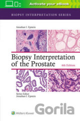 Biopsy Interpretation of the Prostate