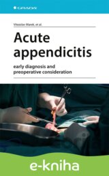 Acute appendicitis