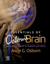 Essentials of Osborn's Brain
