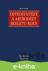 Osteosyntézy a artrodézy skeletu ruky