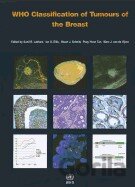 Who Classification of Tumours of the Breast