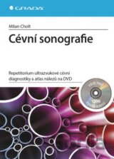 Cévní sonografie