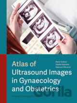 Atlas of Ultrasound Images in Gynaecology and Obstetrics