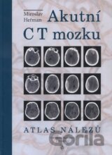 Akutní CT mozku