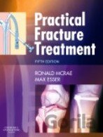 Practical Fracture Treatment