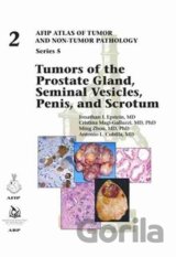 Tumors of the Prostate Gland, Seminal Vesicles, Penis, and Scrotum