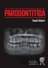 Parodontitída
