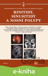 Rinitidy, sinusitidy a nosní polypy