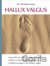 Hallux valgus