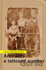 Arm with a tattooed number