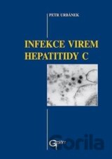 Infekce virem hepatitidy C