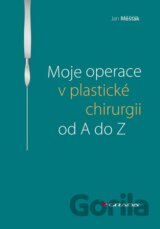 Moje operace v plastické chirurgii od A do Z