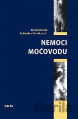 Nemoci močovodu