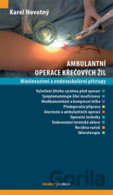 Ambulantní operace křečových žil