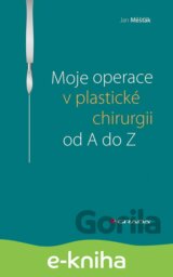 Moje operace v plastické chirurgii od A do Z
