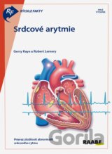 Srdcové arytmie