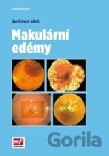 Makulární edémy