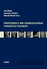 Protokoly MR zobrazování
