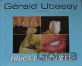 Trucs et astuces