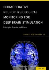 Intraoperative Neurophysiological Monitoring for Deep Brain Stimulation