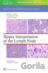 Biopsy Interpretation of the Lymph Node