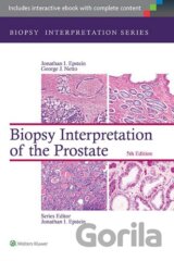 Biopsy Interpretation of the Prostate