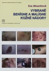 Vybrané benígne a malígne kožné nádory