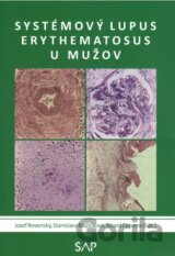 Systemovy lupus erythematosus u muzov