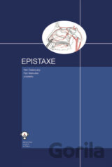 Epistaxe