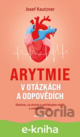 Arytmie v otázkách a odpovědích